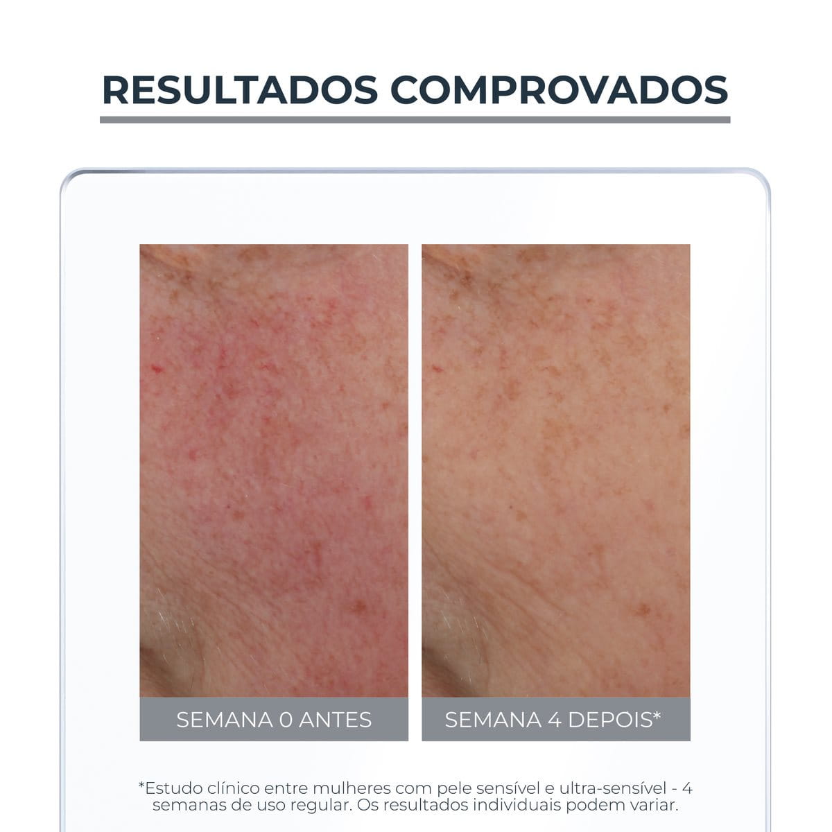 Fluido Neutralizante Eucerin Anti Redness FPS 30 50ml para Pele Sensível